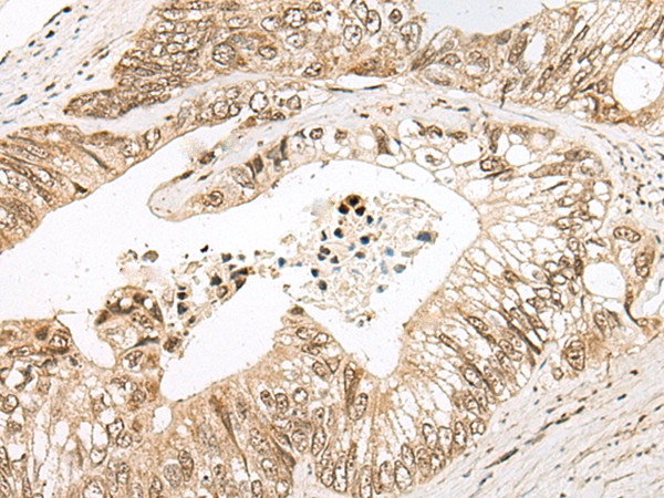 TSEN15 Antibody in Immunohistochemistry (Paraffin) (IHC (P))