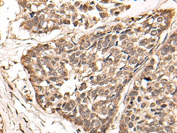 WDFY3 Antibody in Immunohistochemistry (Paraffin) (IHC (P))