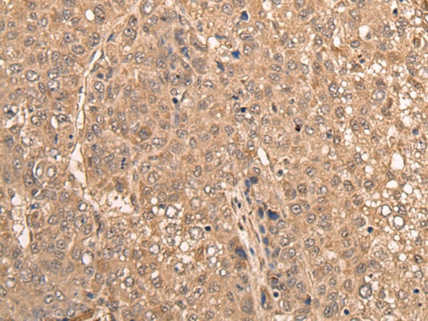 WDFY3 Antibody in Immunohistochemistry (Paraffin) (IHC (P))