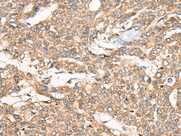 ZXDA Antibody in Immunohistochemistry (Paraffin) (IHC (P))