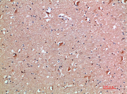 IL18RAP Antibody in Immunohistochemistry (Paraffin) (IHC (P))