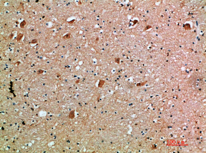 IL18RAP Antibody in Immunohistochemistry (Paraffin) (IHC (P))