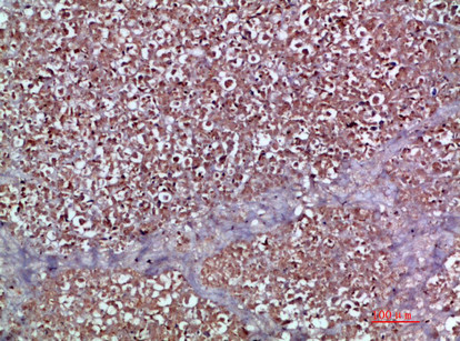 MIP-3 alpha Antibody in Immunohistochemistry (Paraffin) (IHC (P))