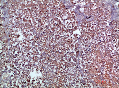 MIP-3 alpha Antibody in Immunohistochemistry (Paraffin) (IHC (P))