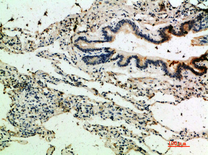 Thrombospondin 4 Antibody in Immunohistochemistry (Paraffin) (IHC (P))