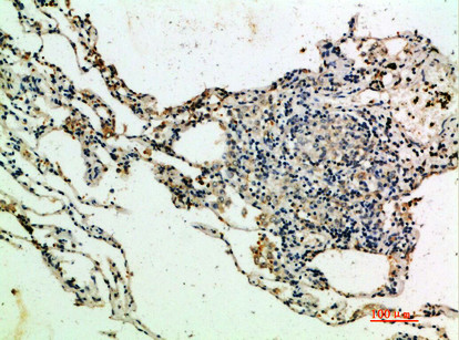 Thrombospondin 4 Antibody in Immunohistochemistry (Paraffin) (IHC (P))