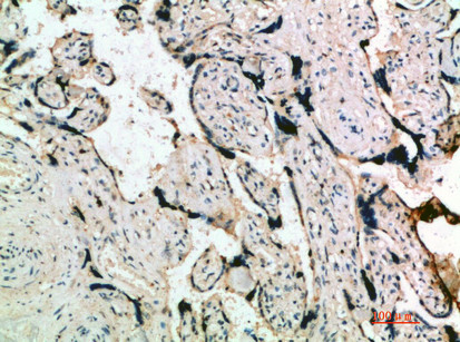 INHA Antibody in Immunohistochemistry (Paraffin) (IHC (P))