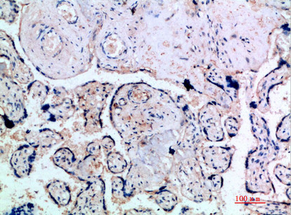 INHA Antibody in Immunohistochemistry (Paraffin) (IHC (P))