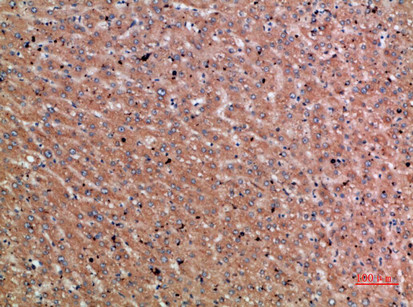 Chordin Antibody in Immunohistochemistry (Paraffin) (IHC (P))