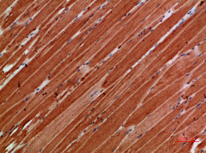 Titin Antibody in Immunohistochemistry (Paraffin) (IHC (P))