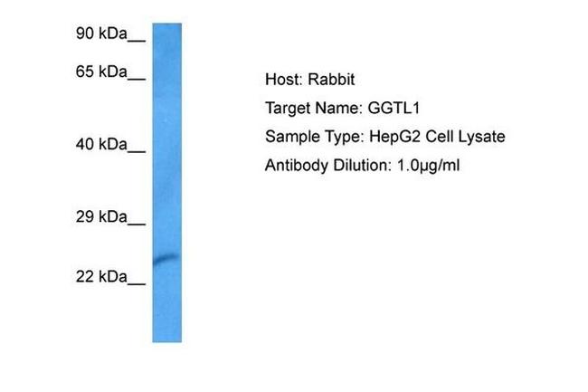 GGTLC1 Antibody in Western Blot (WB)