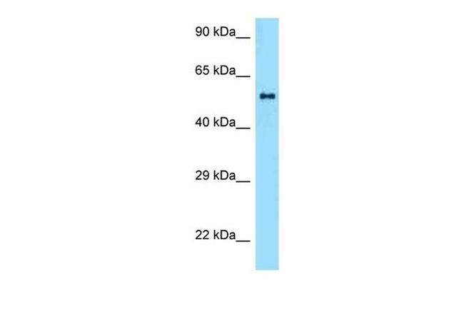 ZBTB37 Antibody in Western Blot (WB)