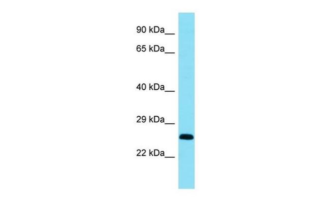 BCL11A Antibody in Western Blot (WB)