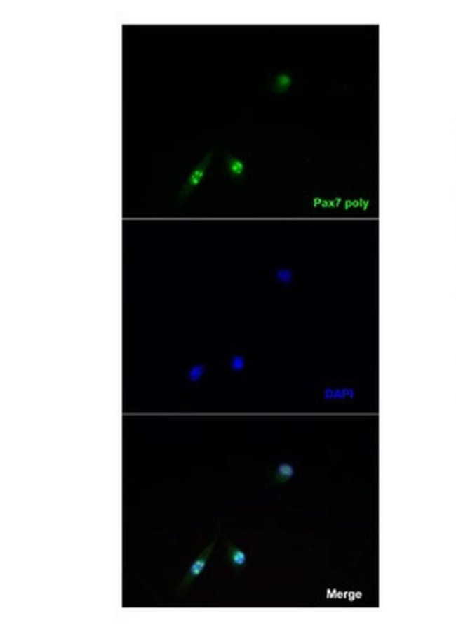 PAX7 Antibody in Immunocytochemistry (ICC/IF)