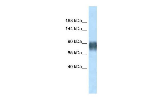 AVIL Antibody in Western Blot (WB)