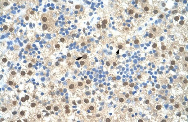 RIP3 Antibody in Immunohistochemistry (IHC)