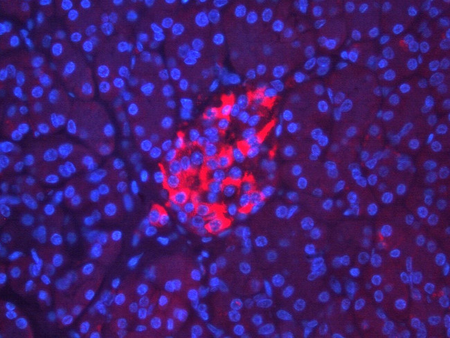 RIP3 Antibody in Immunohistochemistry (IHC)