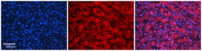 SLC26A3 Antibody in Immunohistochemistry (Paraffin) (IHC (P))