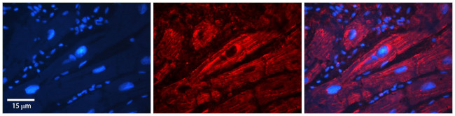 SLC26A3 Antibody in Immunohistochemistry (Paraffin) (IHC (P))