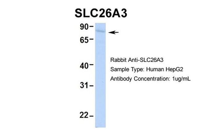 SLC26A3 Antibody in Western Blot (WB)