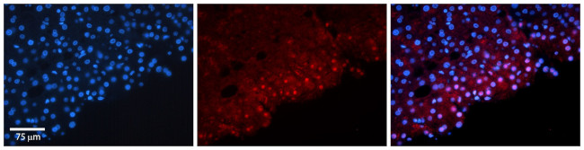 FosB Antibody in Immunohistochemistry (IHC)