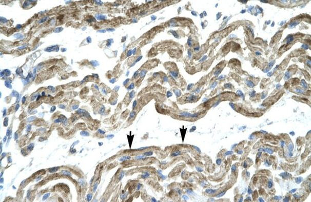 APOBEC3G Antibody in Immunohistochemistry (IHC)