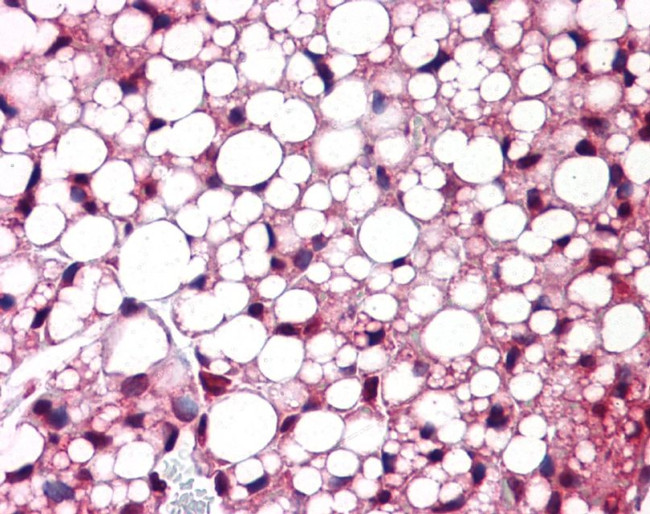 ATF6 Antibody in Immunohistochemistry (IHC)