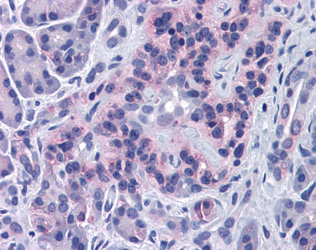 SIRT4 Antibody in Immunohistochemistry (IHC)