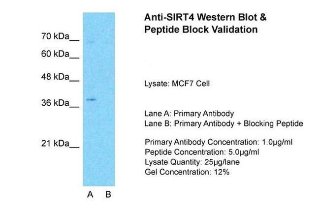 SIRT4 Antibody in Western Blot (WB)