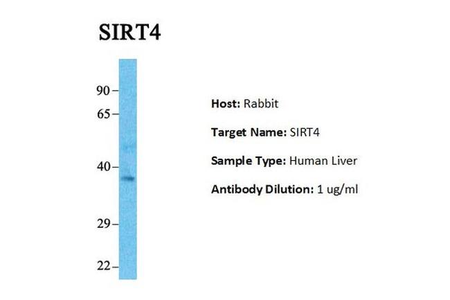 SIRT4 Antibody in Western Blot (WB)