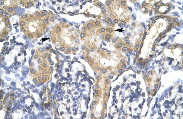 ACSL1 Antibody in Immunohistochemistry (IHC)