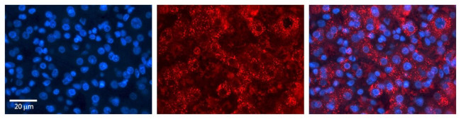 ACSL1 Antibody in Immunohistochemistry (IHC)