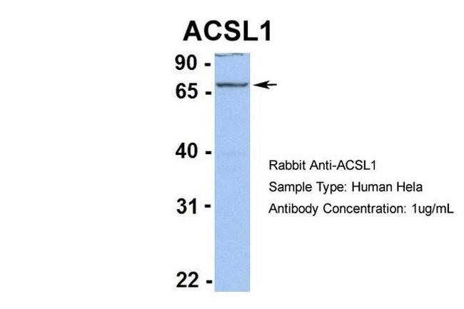 ACSL1 Antibody in Western Blot (WB)