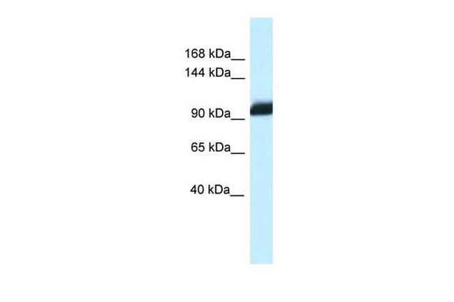 ZHX1 Antibody in Western Blot (WB)