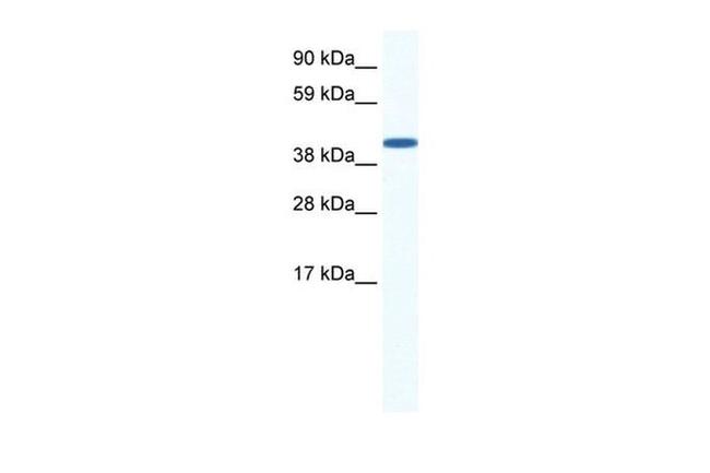 ZFP36L1 Antibody in Western Blot (WB)