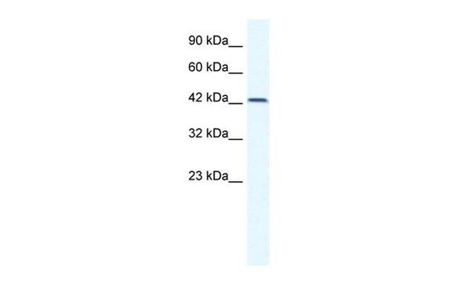 TBX6 Antibody in Western Blot (WB)