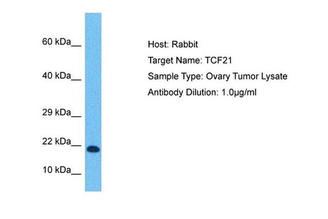 TCF21 Antibody in Western Blot (WB)