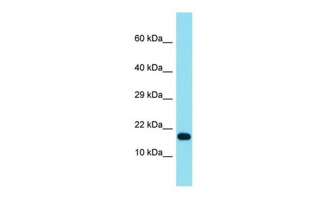 TCF21 Antibody in Western Blot (WB)