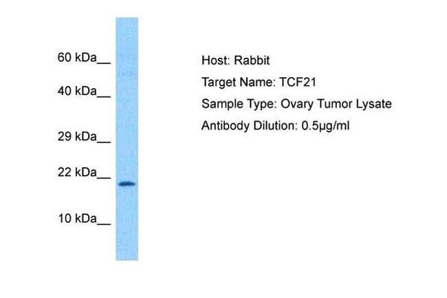 TCF21 Antibody in Western Blot (WB)