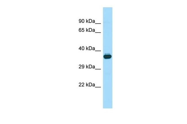 WNT8B Antibody in Western Blot (WB)