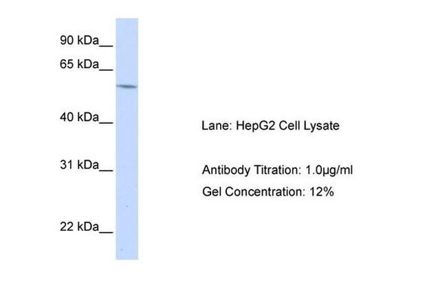 ACAT2 Antibody in Western Blot (WB)