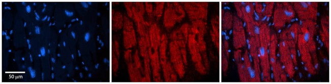 KIF23 Antibody in Immunohistochemistry (Paraffin) (IHC (P))