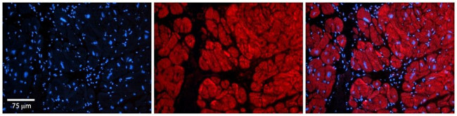 Tankyrase Antibody in Immunohistochemistry (Paraffin) (IHC (P))