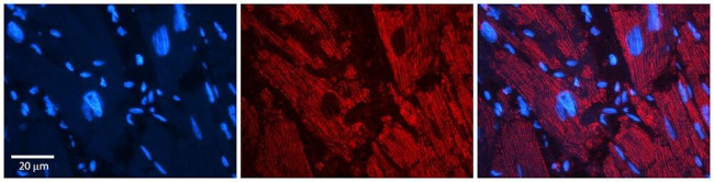 Zyxin Antibody in Immunohistochemistry (Paraffin) (IHC (P))