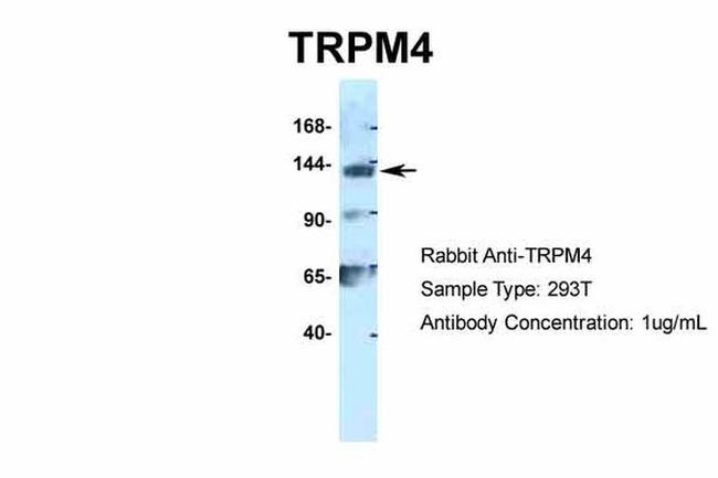 TRPM4 Antibody in Western Blot (WB)