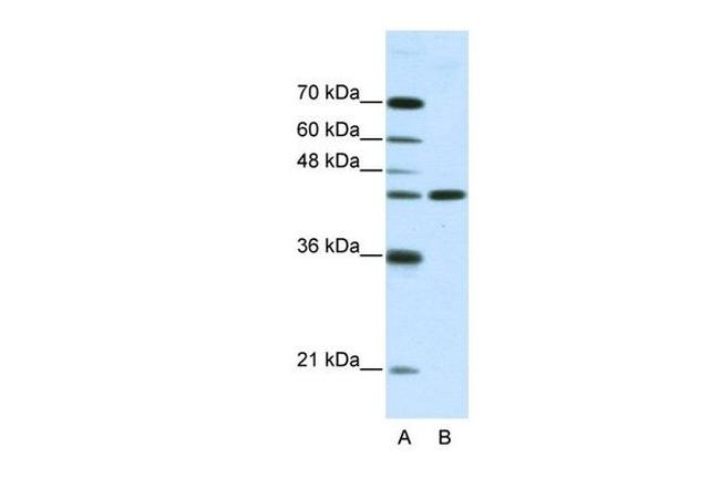 NMUR2 Antibody in Western Blot (WB)