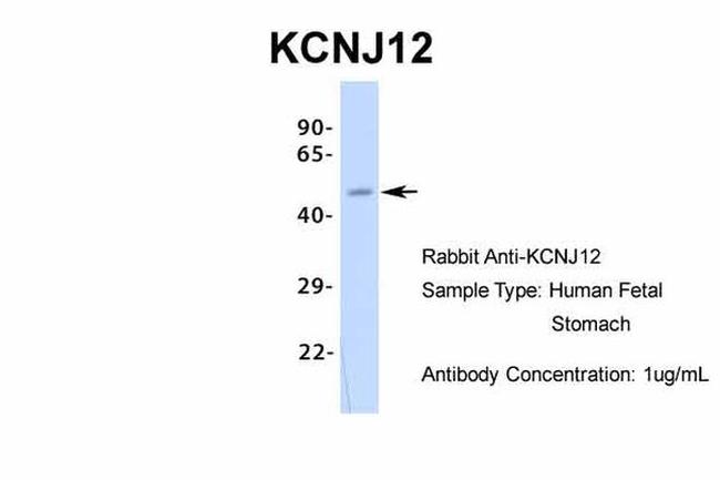 Kir2.2 (KCNJ12) Antibody in Western Blot (WB)