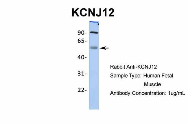 Kir2.2 (KCNJ12) Antibody in Western Blot (WB)