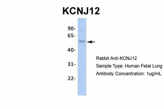 Kir2.2 (KCNJ12) Antibody in Western Blot (WB)