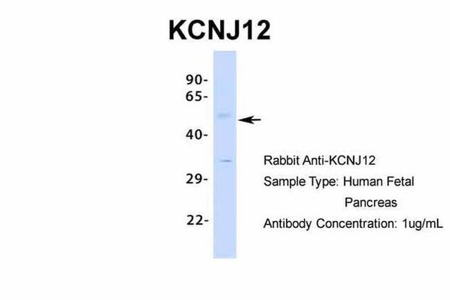 Kir2.2 (KCNJ12) Antibody in Western Blot (WB)